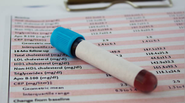 Lipid Profile