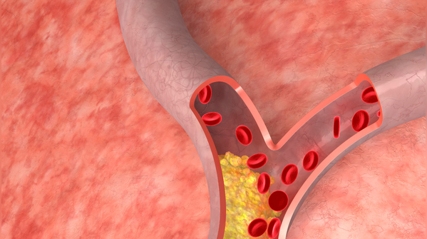 Cholesterol isn’t the only number you should be tracking