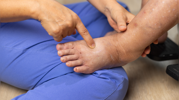 Diabetic Feet: steps save limbs