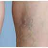5 signs your legs can warn you about hidden diseases