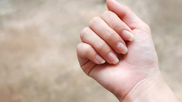Health alert: 5 warning signs on nails you should not ignore