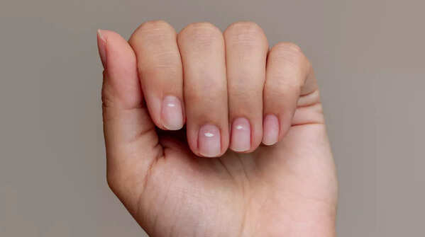 White spots on nails