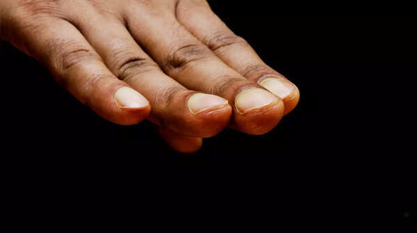 Spoon-shaped nails