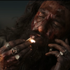 Bloodied hands and heartbreak