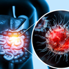 Colorectal cancer symptoms