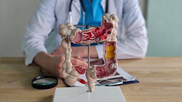 Colorectal cancer seems to be affecting young people more these days, then why no one seems to be paying attention
