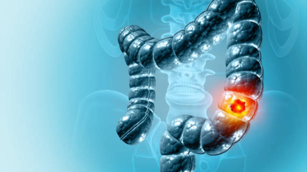 Why painless symptoms can be more concerning