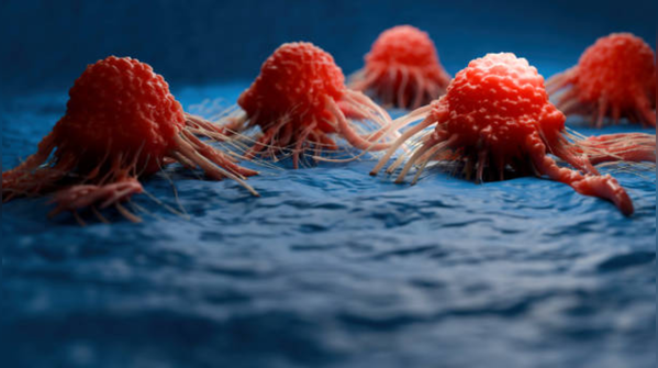 India has a huge cancer burden that’s been steadily growing