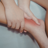 Swelling in the legs, ankles, or feet