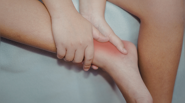 Swelling in the legs, ankles, or feet
