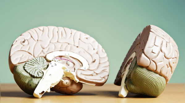 How to deal with brain fog in daily life
