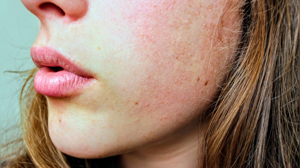 Dry skin that feels tight, not just rough