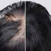 The truth about hair regrowth