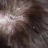 Bring back traditional scalp care