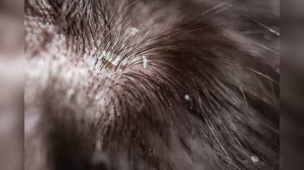 Bring back traditional scalp care