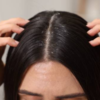Cool your scalp before you try anything else