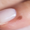 Brittle or ridged nails may reflect nutritional gaps or stress