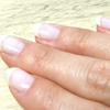 Article image for: Pale or spoon-shaped nails may signal iron deficiency