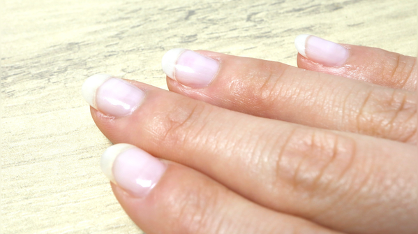 Pale or spoon-shaped nails may signal iron deficiency