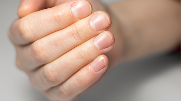 What your nails quietly reveal about your health