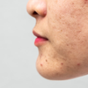 What are closed or trapped pores?