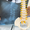 Hidden health conditions that may affect bone strength