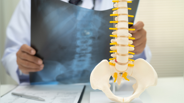 Hidden health conditions that may affect bone strength
