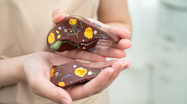 What exactly is fatty liver disease?