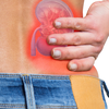 Article image for: Practical ways to prevent gout and kidney stones