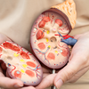 Can high-protein diets harm the kidneys?