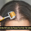 Article image for: Struggling With <i class="tbold">hair loss</i>?