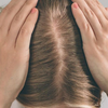 Focus on your scalp health