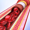 Why early screening is becoming more important