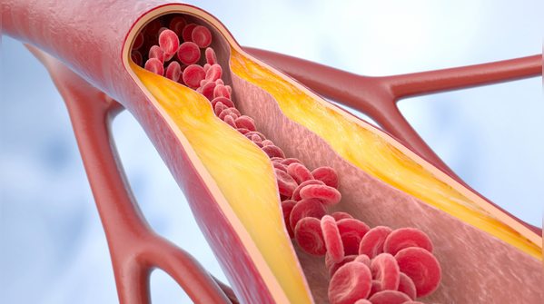 What does artery ageing in your 30s mean for overall health?