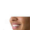 Article image for: Rounded tooth edges? Track wear before it progresses