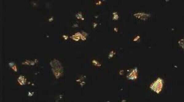 Urine Crystals from Humans ‘research gate’