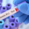 Article image for: Vitamin D and B12 Tests