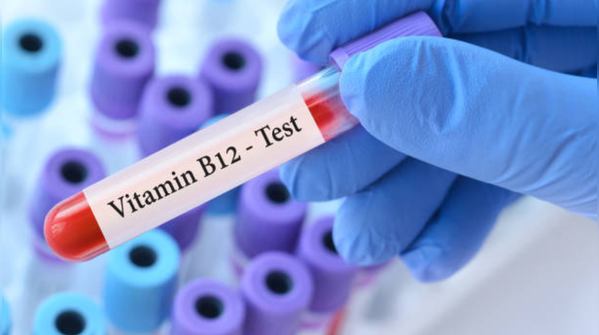 Vitamin D and B12 Tests