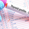 Thyroid Function Test (TSH)