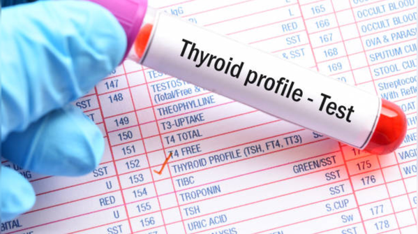 Thyroid Function Test (TSH)