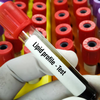 Lipid profile (cholesterol test)