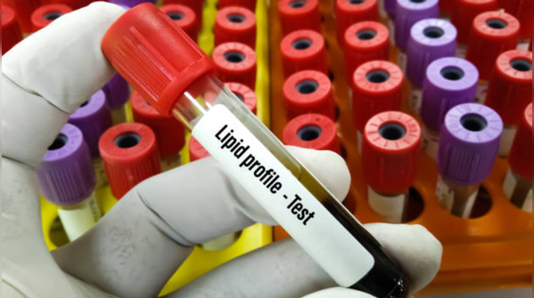 Lipid profile (cholesterol test)