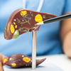 What fatty liver really means inside the body