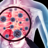 Diagnosis still comes too late