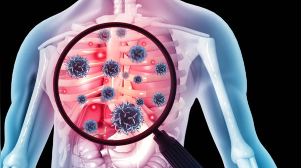 Diagnosis still comes too late