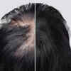 Article image for: Be <i class="tbold">patient</i>