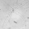 Myxozoa: Microscopic creatures