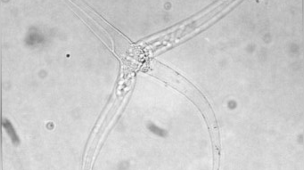 Myxozoa: Microscopic creatures