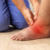 Swelling in the legs is not always about water
