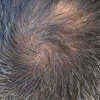 What exactly is a Cowlick?